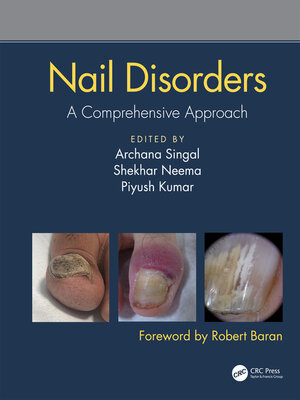 cover image of Nail Disorders